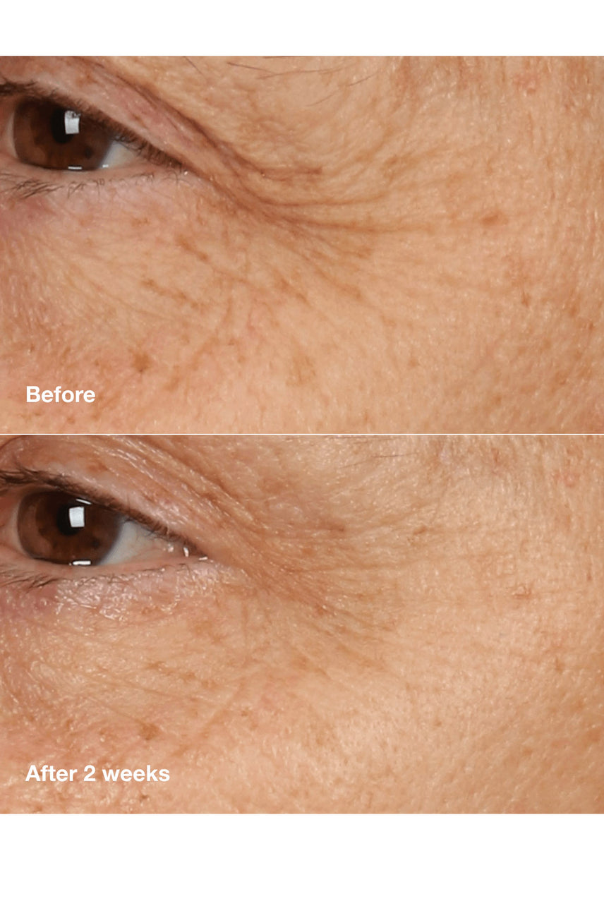 CLINIQUE Smart Clinical Repair Overnight Recovery Cream + Mask 50ml - Life Pharmacy St Lukes