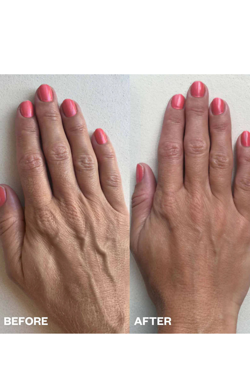 WRINKLES SCHMINKLES Smoothing Kit Hand - Life Pharmacy St Lukes