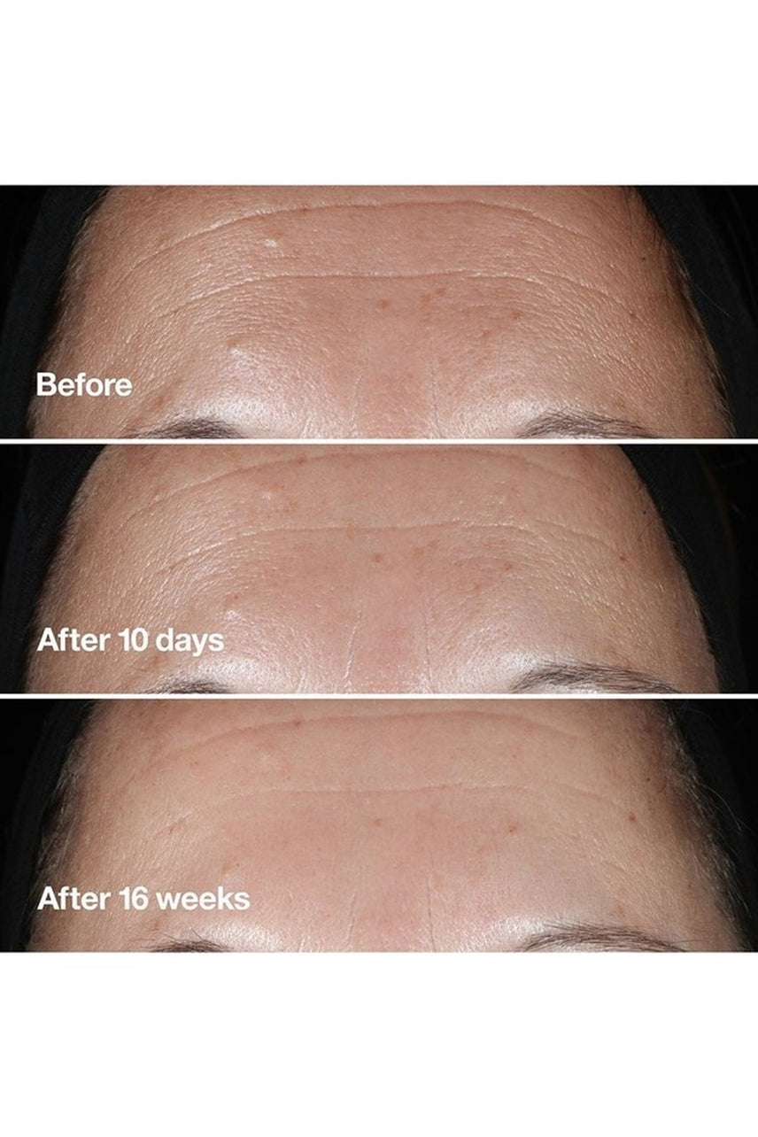 CLINIQUE Smart Clinical Repair Correction Serum 50ml - Life Pharmacy St Lukes