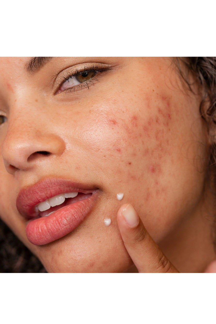 DERMALOGICA Clear Start Post Breakout Fix 15ml - Life Pharmacy St Lukes