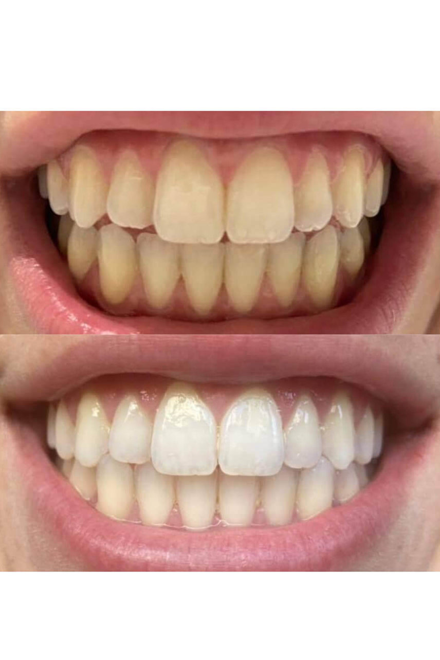 GEM Whitening Pen Coconut Mint 4ml - Life Pharmacy St Lukes