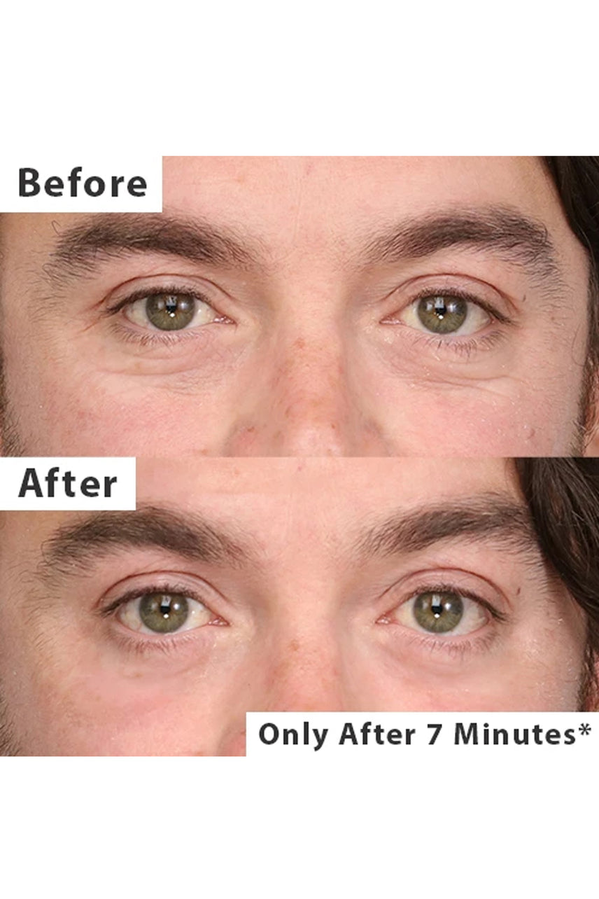 Thin Lizzy Puffy Eye Remover Microcream 25ml - Life Pharmacy St Lukes