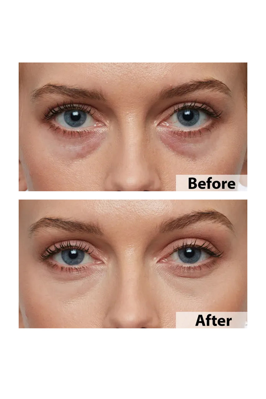 Thin Lizzy Age-Reverse Under Eye Concealer Duchess 7ml - Life Pharmacy St Lukes