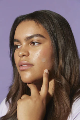 SKIN CONTROL Micro Dart Pimple Patch 9pk - Life Pharmacy St Lukes