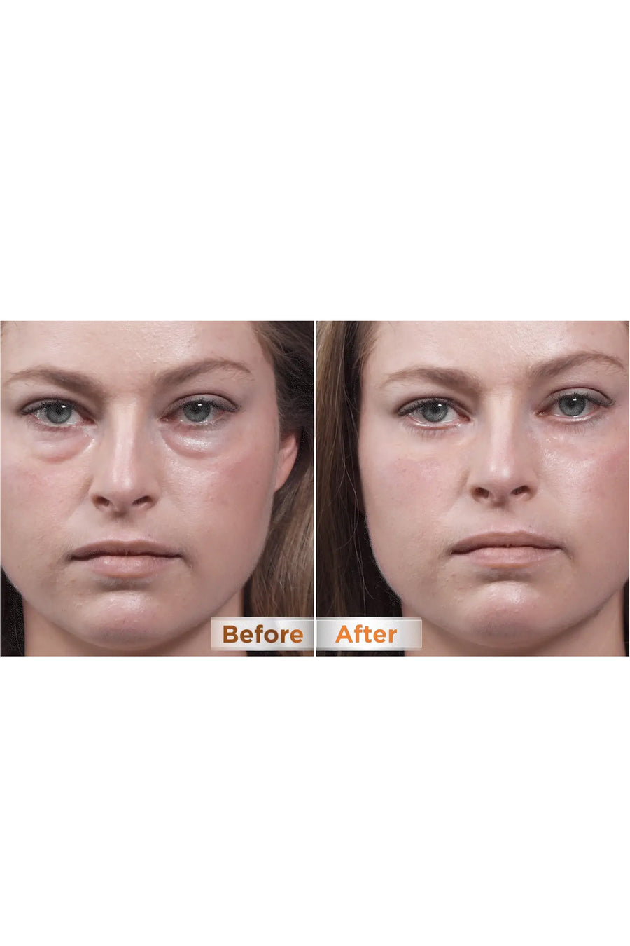 THIN LIZZY Puffy Eye Remover - Life Pharmacy St Lukes