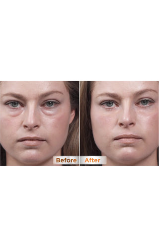 THIN LIZZY Puffy Eye Remover - Life Pharmacy St Lukes