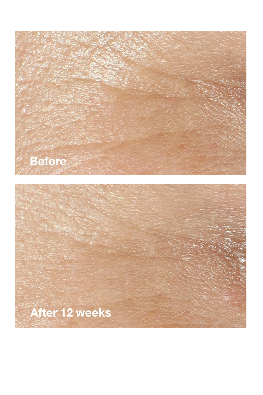 CLINIQUE Smart Clinical Repair Wrinkle Correcting Cream 50ml - All Skin Types - Life Pharmacy St Lukes